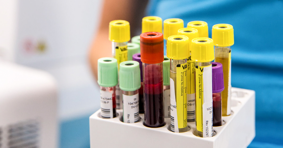 How many types of blood tests are there?