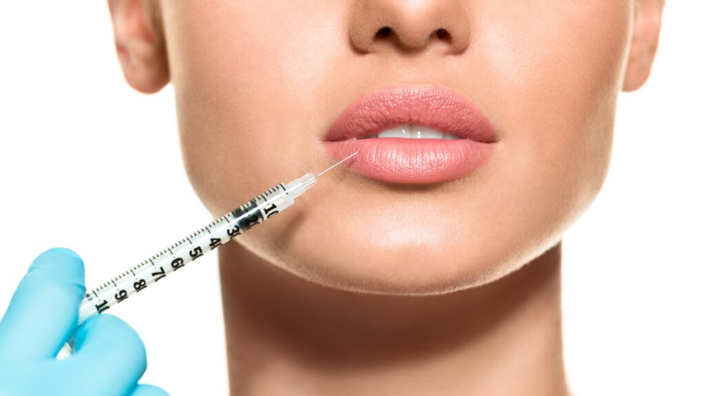 LIP FILLERS: ALL THAT YOU NEED TO KNOW