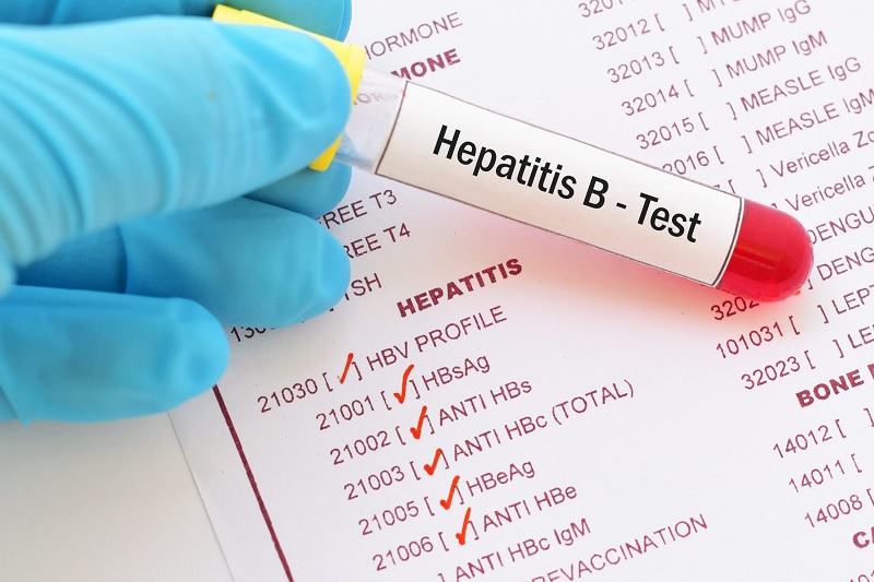 An Overview of Hepatitis and health screening