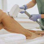 How to Prepare for a Laser Hair Removal Treatment?