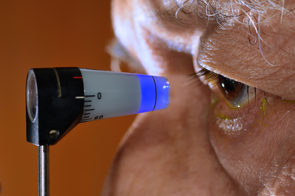 Understanding Glaucoma: Protect Your Vision Before It’s Too Late