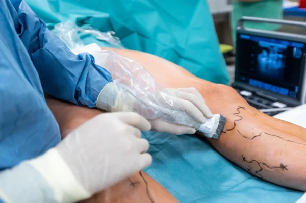Understanding the Role of a Vascular Surgeon in Modern Medicine